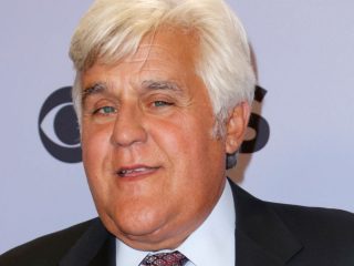 Jay Leno sufre quemaduras graves en la cara después de un accidente automovilístico